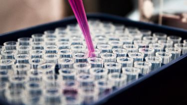 Cell culture 