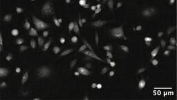 cells under microscope